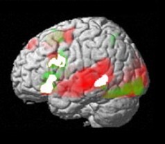 Brain areas activated by listening and reading comprehension